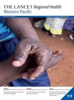 Ear disease, hearing loss, and cognitive outcomes in high school children who were previous participants in a randomized placebo controlled trial of an 11 valent conjugate pneumococcal vaccine administered in infancy