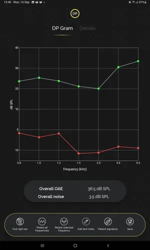 hearOAE - DP gram result screen